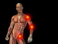 Conceptual human body anatomy pain on black Royalty Free Stock Photo