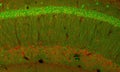 Confocal microscopy image of cells in the hippocampus of the mouse brain