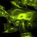 Confocal microscopy of fibroblast cells