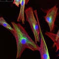 Confocal microscopy of fibroblast cells