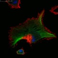 Confocal microscopy of fibroblast cells