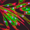 Confocal microscopy of fibroblast cells