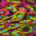 Confocal microscopy of fibroblast cells