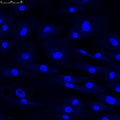 Confocal microscopy of fibroblasts nuclei