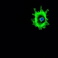 Confocal microscopy imaging of a single cancer cell invading Royalty Free Stock Photo