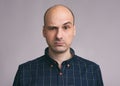 Confused guy. Puzzled young bald man Royalty Free Stock Photo