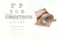 Conjuctivitis disease poster with eye test chart and blue eye.