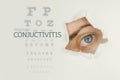 Conjuctivitis disease poster with eye test chart and blue eye on right