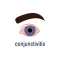 Conjunctivitis icon isolated on white. Watery red eye logo. Viral infection season allergy eye disease virus symptom Royalty Free Stock Photo