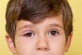 Close-up of kid 4 years old with conjunctivitis.