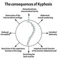 The consequences of kyphosis. Spinal curvature, kyphosis, lordosis, scoliosis, arthrosis. Improper posture and stoop