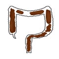 Constipation. Feces in colon. Infographics. Vector illustration on isolated background.