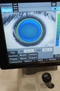 Contact lens application examination window on touchscreen monitor of modern keratometer and refractometer