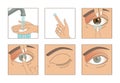 Contact lenses. Instruction how to put on lenses. 5 steps. Wash your hands, take a lens, check the position of the lens