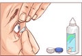 Contact lenses