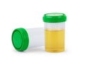 Container with urine for analysis. Isolated