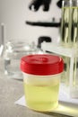 Container with urine sample for analysis and glassware on grey table indoors Royalty Free Stock Photo