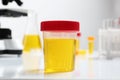Container with urine sample for analysis on table Royalty Free Stock Photo