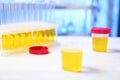 Container with urine sample for analysis on table Royalty Free Stock Photo