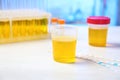 Container with urine sample for analysis on table Royalty Free Stock Photo