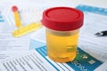 Container with urine sample for analysis on form Royalty Free Stock Photo