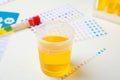 Container with urine sample for analysis on table Royalty Free Stock Photo