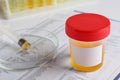 Container with urine sample on table, closeup. Space for text Royalty Free Stock Photo