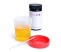 Container with urine and test-strips for the analysis.