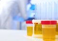 Containers with urine samples on table in laboratory