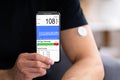 Continuous Glucose Monitor Blood Sugar Test Royalty Free Stock Photo