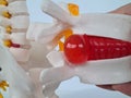Convex red intervertebral disc herniation on model of spine Royalty Free Stock Photo