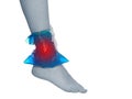 Cool gel pack on a swollen hurting ankle. Royalty Free Stock Photo