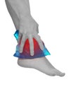 Cool gel pack on a swollen hurting ankle. Royalty Free Stock Photo