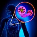 COPD - Chronic obstructive pulmonary disease Royalty Free Stock Photo