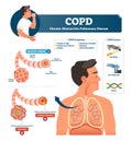 COPD vector illustration. Labeled chronic obstructive pulmonary explanation Royalty Free Stock Photo