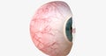 A corneal abrasion, or scratch, is a shallow injury to the surface of the cornea
