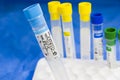 Corona virus and Covid-19 positive test samples. Tubes of blood Royalty Free Stock Photo