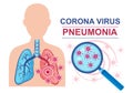 Corona virus pneumonia disease vector sign. Lungs infection. Anatomy respiratory system. Normal and affected lung.