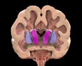 Coronal section of a healthy brain showing normal anatomy of basal baglia and ventricles Royalty Free Stock Photo