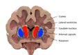 Coronal section of a healthy brain showing normal anatomy of basal baglia and ventricles Royalty Free Stock Photo