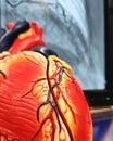 Coronary blockage and heart disease