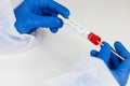 Coronavirus COVID-19 testing kit,swab collection equipment Royalty Free Stock Photo
