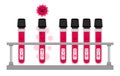 Coronavirus infection. Positive and negative tests for coronavirus.