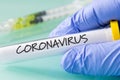 Coronavirus.  Laboratory vial with a virus in a hand in a blue glove Royalty Free Stock Photo