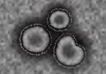 Coronavirus COVID-19 macro illustration, microscope view representation of deadly pathogen infection