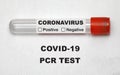 Coronavirus medical testing Royalty Free Stock Photo