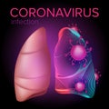 Coronavirus 2019-nCoV infection from Middle East attack the human lungs. Vector illustration of the respiratory syndrome from