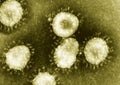 Detail of ultraestructure of deadly coronavirus particles under transmission electron microscopy TEM Royalty Free Stock Photo