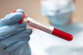 Coronavirus positive blood test. Doctor in protective suit, medical mask and latex gloves holds a test tube with blood