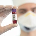 Coronavirus research laboratory doctor blood, virus analysis